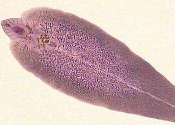 Печеночная двуустка